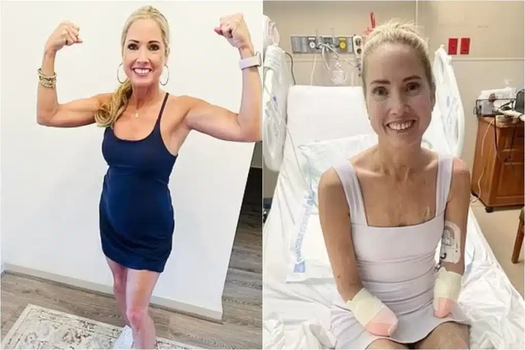 Professora tem mãos e pés amputados por dor de garganta.