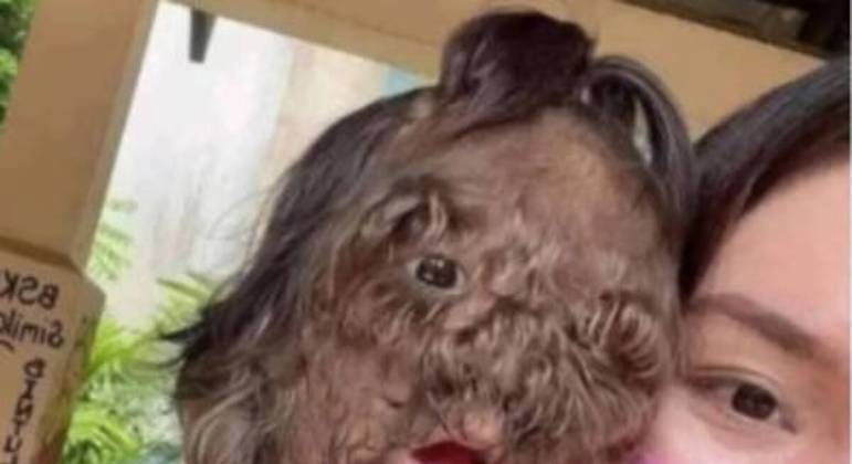 Descubra a história da pequena Adik, portadora da Síndrome do Lobisomem.