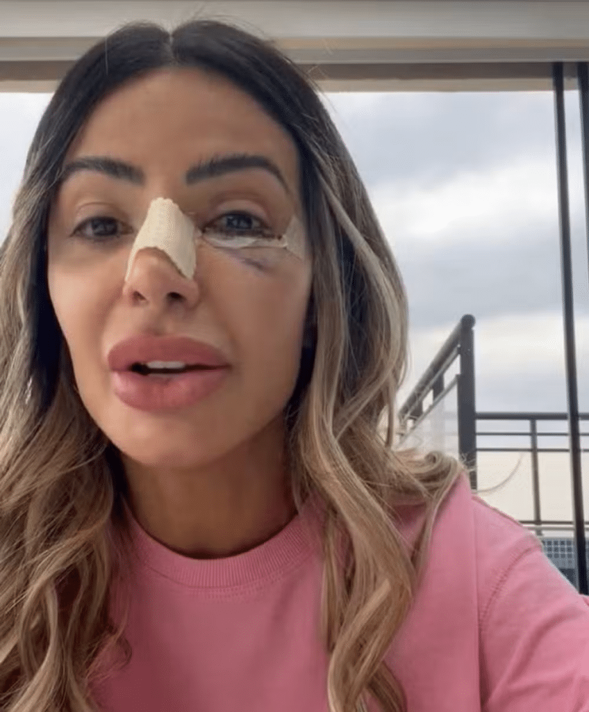 Influenciadora Janaina Prazeres foi agredida pelo namorado durante viagem em Paris