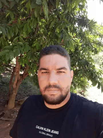 Homem recebe transplante de ossos na canela