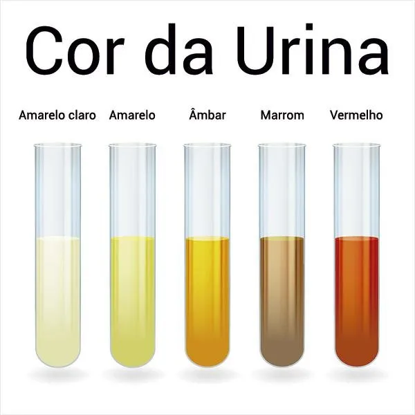 Descubra mais sobre seu organismo através da cor da urina